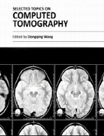 مباحث منتخب در توموگرافی (پرتونگاری مقطعی) رایانه ایSelected Topics on Computed Tomography