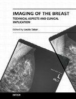 تصویر برداری از سینه – جنبه های فنی و مفهوم بالینیImaging of the Breast