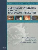 انکیلوزان اسپوندیلیت و اسپوندیلو آرتروپاتی ها – همنشینی برای روماتولوژیAnkylosing Spondylitis and the Spondyloarthropathies