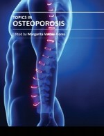 مباحث در پوکی استخوان (استئوپوروز)Topics in Osteoporosis