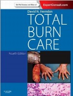 مراقبت از سوختگی کاملTotal Burn Care