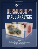 تجزیه و تحلیل تصویر درموسکوپیDermoscopy Image Analysis