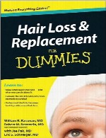 ریزش مو و جایگزینی به زبان سادهHair Loss and Replacement For Dummies