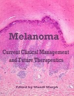 ملانوم – مدیریت بالینی فعلی و درمان های آتیMelanoma