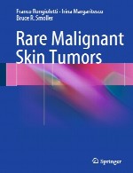 تومور های پوستی بدخیم نادرRare Malignant Skin Tumors
