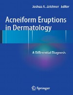 جوش های آکنیفرم (فرم آکنه) در درماتولوژی – تشخیص افتراقیAcneiform Eruptions in Dermatology