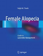 آلوپسی زن – راهنمای مدیریت موفقFemale Alopecia