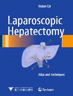 ایلئوسکوپی – تکنیک، تشخیص، و کاربرد های بالینیLaparoscopic Hepatectomy
