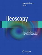 ایلئوسکوپی – تکنیک، تشخیص، و کاربرد های بالینیIleoscopy