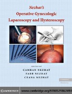 عمل لاپاروسکوپی و هیستروسکوپی زنان نزهتNezhat’s Operative Gynecologic Laparoscopy and Hysteroscopy