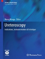 یورتروسکوپی – موارد مصرف، ابزار دقیق و تکنیکUreteroscopy