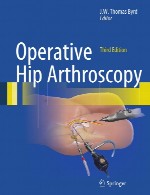 آرتروسکوپی عمل هیپ (مفصل ران)Operative Hip Arthroscopy