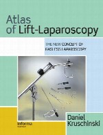 اطلس لیفت - لاپاروسکوپیAtlas of Lift-Laparoscopy