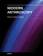 آرتروسکوپی (بررسی درون مفصل) مدرنModern Arthroscopy