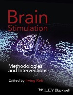 تحریک مغز - روش ها و مداخلاتBrain Stimulation