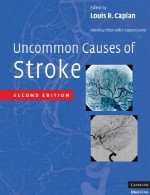علل غیر معمول سکته مغزیUncommon Causes of Stroke