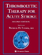 درمان ترومبولیتیک برای سکته مغزی حادThrombolytic Therapy for Acute Stroke