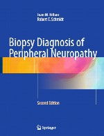 تشخیص بیوپسی نوروپاتی محیطیBiopsy Diagnosis of Peripheral Neuropathy