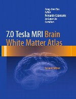 اطلس 7.0 تسلا MRI ماده سفید مغز7.0Tesla MRI Brain White Matter Atlas