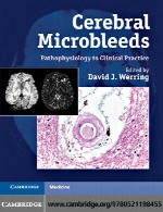 میکرو خونریزی های مغزی – پاتوفیزیولوژی تا عمل بالینیCerebral Microbleeds