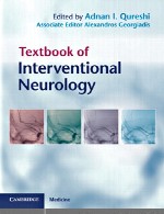 درسنامه نورولوژی مداخله ایTextbook of Interventional Neurology