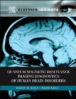 تشخیصی تصویربرداری رزونانس مغناطیسی کوانتومی اختلالات مغز انسانQuantum Magnetic Resonance Imaging