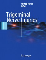 آسیب های عصب سه قلوTrigeminal Nerve Injuries