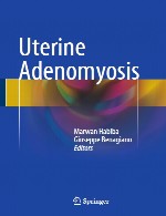 آدنومیوز رحمیUterine Adenomyosis