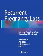 سقط مکرر - ارزیابی مبتنی بر شواهد، تشخیص و درمانRecurrent Pregnancy Loss