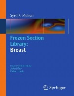 کتابخانه بخش منجمد: پستانFrozen Section Library: Breast