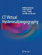 هیستروسالپینگوگرافی مجازی CTCT Virtual Hysterosalpingography