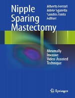ماستکتومی نوک پستان – تکنیک های حمایت شده با ویدیو با حداقل تهاجمNipple Sparing Mastectomy
