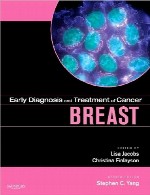 تشخیص زود هنگام و درمان سری های سرطان – سرطان سینهBreast Cancer