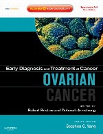 تشخیص زود هنگام و درمان سری های سرطان – سرطان تخمدانOvarian Cancer
