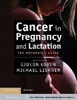 سرطان در دوران بارداری و شیردهیCancer in Pregnancy and Lactation