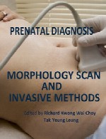 تشخیص پیش از تولد (پری ناتال) – اسکن مورفولوژی و روش های درون کارPrenatal Diagnosis