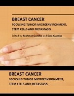 سرطان سینه – تمرکز بر ریز محیط تومور، سلول های بنیادی و متاستازBreast Cancer