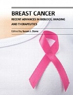 سرطان سینه – پیشرفت های اخیر در زیست شناسی، تصویربرداری و درمانBreast Cancer