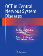 OCT در بیماری های سیستم عصبی مرکزی - چشم به عنوان یک پنجره به مغزOCT in Central Nervous System Diseases