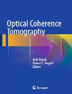 توموگرافی انسجام نوریOptical Coherence Tomography