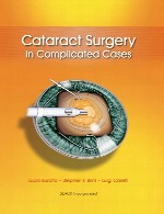 عمل جراحی آب مروارید در موارد پیچیدهCataract Surgery in Complicated Cases