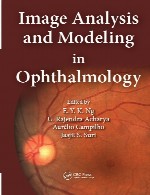 تجزیه و تحلیل و مدلسازی تصویر در چشم پزشکیImage Analysis and Modeling in Ophthalmology
