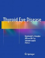 بیماری چشم تیروئیدThyroid Eye Disease