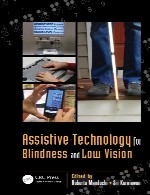 فناوری کمکی برای نابینایی و دید کمAssistive Technology for Blindness and Low Vision