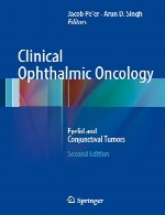 انکولوژی بالینی چشمی – تومور های پلک و ملتحمهClinical Ophthalmic Oncology