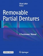 پروتز های دندانی جزئی برداشتنی – راهنمای یک متخصصRemovable Partial Dentures