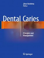 پوسیدگی دندان - اصول و مدیریتDental Caries