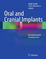 ایمپلنت های دهان و جمجمه ای (اورال و کرانیال) – تحولات تحقیق اخیرOral and Cranial Implants