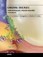 بیماری های لثه، اتیولوژی (سبب شناسی)، پیشگیری و درمان آنهاGingival Diseases