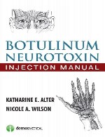 راهنمای تزریق نوروتوکسین بوتولینومBotulinum Neurotoxin Injection Manual